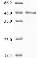 Human Vascular endothelial growth factor C (VEGFC) Recombinant Protein, C-His - BioCrest Sci