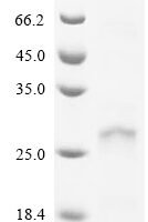 Human papillomavirus type 16 Protein E6 (E6) Recombinant Protein, C-His - BioCrest Sci