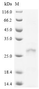 Human papillomavirus type 16 Protein E6 (E6) Recombinant Protein, C-His, Human papillomavirus type 16, E.coli, C-terminal 6xHis-tagged, 26.1 kDa, purity >≥ 85% as determined by SDS-PAGE.