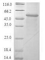 Human Glutathione S-transferase A2 (GSTA2) Recombinant Protein - BioCrest Sci
