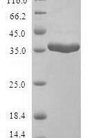 Human Mammaglobin-A (SCGB2A2) Recombinant Protein, N-GST - BioCrest Sci