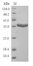 Human Mammaglobin-A (SCGB2A2) Recombinant Protein, N-GST, Homo sapiens (Human), E.coli, N-terminal GST-tagged, 37.5 kDa, purity >≥ 90% as determined by SDS-PAGE.