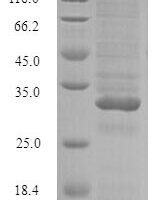 Arachis hypogaea Conglutin Recombinant Protein - BioCrest Sci