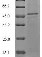 Staphylococcus aureus Alpha-hemolysin (hly) Recombinant Protein, N-His-SUMO - BioCrest Sci