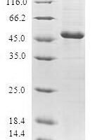 Human Grancalcin (GCA) Recombinant Protein - BioCrest Sci