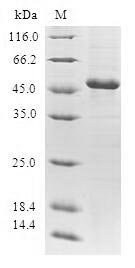 Human Grancalcin (GCA) Recombinant Protein, Homo sapiens (Human), E.coli, N-terminal GST-tagged, 51.0 kDa, purity >≥ 90% as determined by SDS-PAGE.