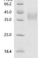 Human Asialoglycoprotein receptor 1 (ASGR1), partial Recombinant Protein, N-10His - BioCrest Sci