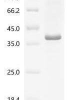 Human Protein Wnt-3a (WNT3A), partial Recombinant Protein, N-His/C-His - BioCrest Sci