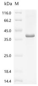 Human Protein Wnt-3a (WNT3A), partial Recombinant Protein, N-His/C-His, Homo sapiens (Human), E.coli, N-terminal 6xHis-tagged and C-terminal 6xHis-tagged, 47.3 kDa, purity >≥ 85% as determined by SDS-PAGE.