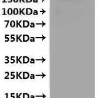 Human Sodium/glucose cotransporter 2 (SLC5A2)-VLPs Recombinant Protein - BioCrest Sci