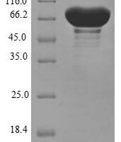 Human Cytochrome P450 11B1, mitochondrial (CYP11B1) Recombinant Protein, N-10His-SUMO/C-Myc - BioCrest Sci