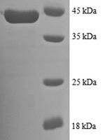 Human NADH dehydrogenase [ubiquinone] 1 beta subcomplex subunit 7 (NDUFB7) Recombinant Protein - BioCrest Sci