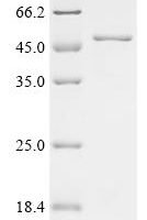 Human Ubiquitin carboxyl-terminal hydrolase 21 (USP21), partial Recombinant Protein - BioCrest Sci