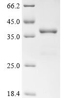 Mouse Protein Wnt-3a (Wnt3a), partial Recombinant Protein - BioCrest Sci