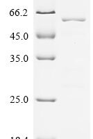 Human Serine/threonine-protein phosphatase PGAM5,mitochondrial (PGAM5), partial Recombinant Protein - BioCrest Sci
