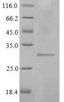 Staphylococcus aureus Enterotoxin type E (entE) Recombinant Protein, N-His-Myc - BioCrest Sci