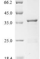 Human Arylamine N-acetyltransferase 1 (NAT1) Recombinant Protein - BioCrest Sci