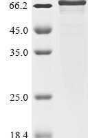 Mouse Regulator of G-protein signaling 14 (Rgs14) Recombinant Protein - BioCrest Sci