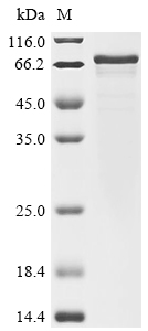 Mouse Regulator of G-protein signaling 14 (Rgs14) Recombinant Protein, Mus musculus (Mouse), E.coli, N-terminal 10xHis-tagged and C-terminal Myc-tagged, 67.3 kDa, purity >≥ 85% as determined by SDS-PAGE.