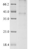 Human Chemerin-like receptor 1 (CMKLR1) Recombinant Protein - BioCrest Sci