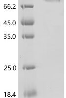 Human Cadherin-17 (CDH17), partial, Biotinylated Recombinant Protein - BioCrest Sci
