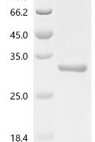 Human NADH dehydrogenase [ubiquinone] 1 beta subcomplex subunit 1 (NDUFB1) Recombinant Protein - BioCrest Sci