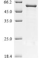 Bovine F-box only protein 39 (FBXO39) Recombinant Protein - BioCrest Sci