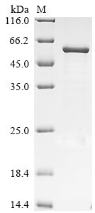 Bovine F-box only protein 39 (FBXO39) Recombinant Protein, Bos taurus (Bovine), E.coli, N-terminal 10xHis-tagged and C-terminal Myc-tagged, 60.2 kDa, purity >≥ 85% as determined by SDS-PAGE.