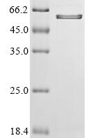 Mouse Osteopontin (Spp1), partial Recombinant Protein, N-10His/C-Myc - BioCrest Sci