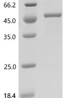 Human Acid ceramidase (ASAH1) Recombinant Protein, C-His - BioCrest Sci