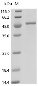 Human Acid ceramidase (ASAH1) Recombinant Protein, C-His, E.coli, C-terminal 6xHis-tagged, 49.6 kDa, purity >≥ 90% as determined by SDS-PAGE.