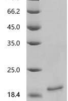 Mouse Non-selective voltage-gated ion channel VDAC2 (Vdac2), partial Recombinant Protein, N-His-SUMOstar - BioCrest Sci