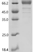 Mouse High affinity immunoglobulin epsilon receptor subunit alpha (Fcer1a), partial Recombinant Protein - BioCrest Sci