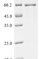 Human Carboxylesterase 3 (CES3) Recombinant Protein - BioCrest Sci