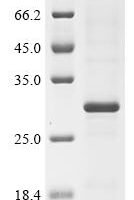 Dermatophagoides pteronyssinus Mite allergen Der p 3 (DERP3) Recombinant Protein, Tag-Free - BioCrest Sci