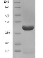 Mouse Interleukin-7 receptor subunit alpha (Il7r), partial Recombinant Protein, N-His - BioCrest Sci