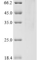 Human Homeobox protein Hox-A3 (HOXA3) Recombinant Protein - BioCrest Sci