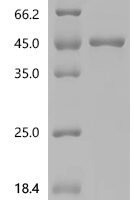 Human Aflatoxin B1 aldehyde reductase member 2 (AKR7A2) Recombinant Protein - BioCrest Sci