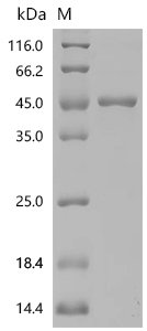 Human Aflatoxin B1 aldehyde reductase member 2 (AKR7A2) Recombinant Protein, Homo sapiens (Human), E.coli, N-terminal 10xHis-tagged and C-terminal Myc-tagged, 47.0 kDa, purity >≥ 85% as determined by SDS-PAGE.