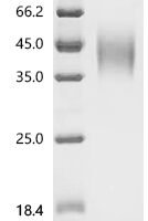 Human Signal transducer CD24 (CD24), partial-Nanoparticle Recombinant Protein - BioCrest Sci