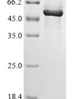 Human Phosphatidylserine decarboxylase proenzyme, mitochondrial (PISD) Recombinant Protein - BioCrest Sci