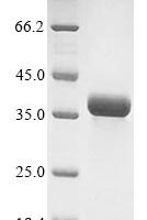Rotavirus A Outer capsid glycoprotein VP7 Recombinant Protein, N-10His/C-Myc, aa 51–326, UniProt P17700 - BioCrest Sci