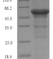 Sorangium cellulosum Mannonate dehydratase (uxuA) Recombinant Protein - BioCrest Sci