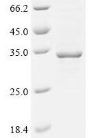 Bovine Isoamyl acetate-hydrolyzing esterase 1 homolog (IAH1) Recombinant Protein - BioCrest Sci