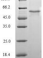 Human Apoptosis facilitator Bcl-2-like protein 14 (BCL2L14) Recombinant Protein - BioCrest Sci