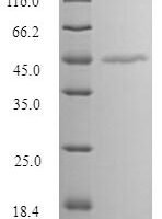 Human Melanoma-associated antigen 1 (MAGEA1) Recombinant Protein - BioCrest Sci