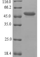 Human Phosphomannomutase 2 (PMM2) Recombinant Protein - BioCrest Sci