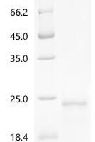 Conus radiatus Iota-conotoxin-like r11c Recombinant Protein, N-His-SUMOstar - BioCrest Sci