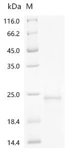 Conus radiatus Iota-conotoxin-like r11c Recombinant Protein, N-His-SUMOstar, Yeast, N-terminal 6xHis-sumostar-tagged, 17.7 kDa, purity >≥ 95% as determined by SDS-PAGE.
