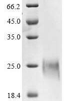 Bovine coronavirus Spike glycoprotein (S), partial Recombinant Protein, C-His, aa 326–540, strain vaccine - BioCrest Sci